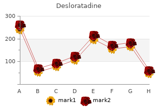 5 mg desloratadine for sale